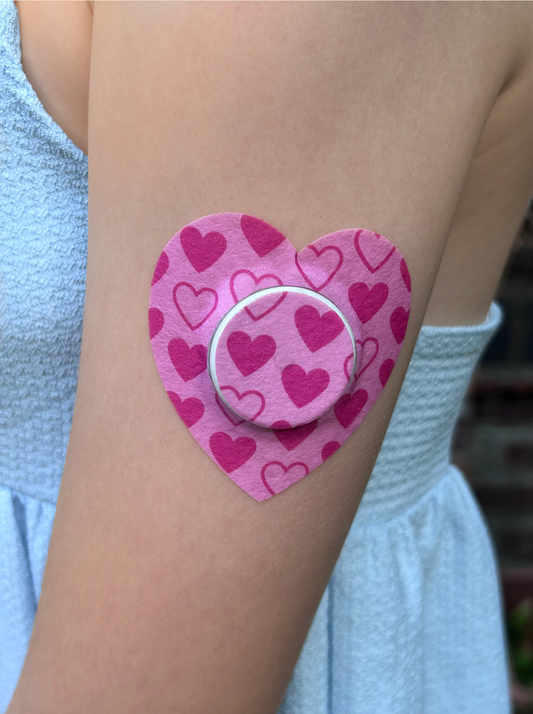 First Sensor Change: A Survival Guide for New T1D Parents