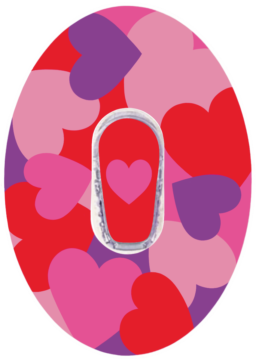 Hearts Dexcom G6 CGM patch for Valentine’s Day by SmileSensors